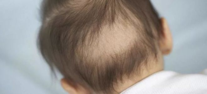 Пятно без волос на голове: что это, почему появляется и как лечить