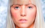 Дерматит на лице у взрослого: причины появления и лечение