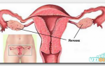 Узи яичников у женщин: норма, как проходит, подготовка, расшифровка результатов