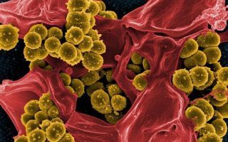 Бактериальный простатит: признаки, возбудители, причины, симптомы. как лечить хронический бактериальный простатит?