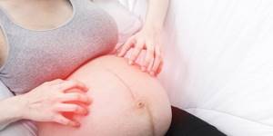 Атопический дерматит у беременных