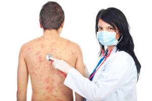 Причины дерматита у детей и взрослых