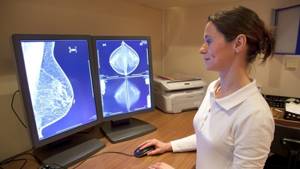 Маммография: что это, как делают, расшифровка результатов