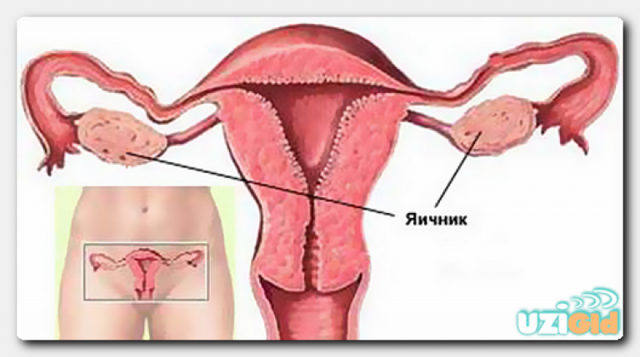 УЗИ яичников у женщин: норма, как проходит, подготовка, расшифровка результатов