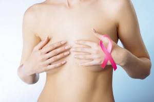 Дольковый рак молочной железы: его лечение и прогноз