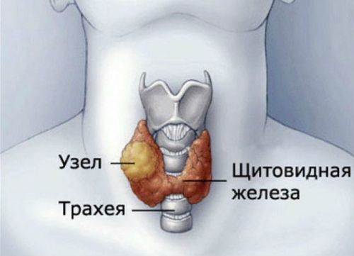 Биопсия щитовидной железы под контролем узи: что это такое