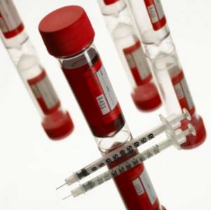 Как правильно сдать анализ крови на инсулин