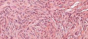 Снижена эхогенность яичника: причины, возможные патологии