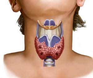 Как проверить щитовидную железу в домашних условиях