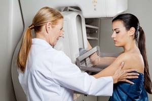 Инфильтративный рак молочной железы: формы заболевания, прогноз выживаемости, лечение