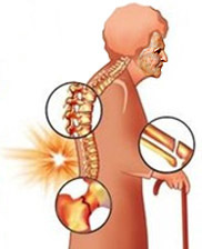 Заболевания поджелудочной железы: симптомы, признаки и причины