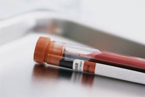 Анализ крови на печеночные пробы — показатели, норма и причины отклонений