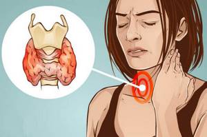 Лечение щитовидной железы гомеопатией: советы врача, препараты