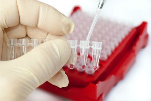 Подготовка к анализу ПСА: как правильно сдать кровь на ПСА общий и свободный, расшифровка результатов