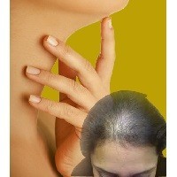 Выпадение волос при заболевании щитовидной железы: причины, и что делать