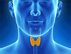 Цистаденома щитовидной железы: что это такое?