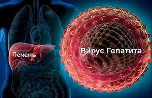 Вирусный гепатит Е - причины, симптомы, диагностика и лечение