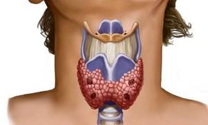 Неоднородная структура щитовидной железы что это такое