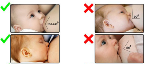 Массаж при лактостазе у кормящих мам: как правильно массировать грудь и устранить застой молока