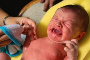 Мастит новорожденных - причины, симптомы, диагностика и лечение