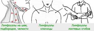 Лимфоузлы и щитовидка: связаны ли они между собой?